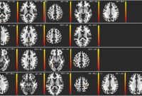 Dl Card Template New Does Resting State Functional Connectivity Differ Between