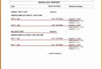 Incident Report form Template Word Awesome Sample Of Investigation Report In the Workplace Glendale Community