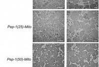 Blank Pattern Block Templates New Peptide Mediated Delivery Of Donor Mitochondria Improves