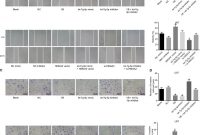 Blank Pattern Block Templates Unique Verbascoside Inhibits Progression Of Glioblastoma Cells by